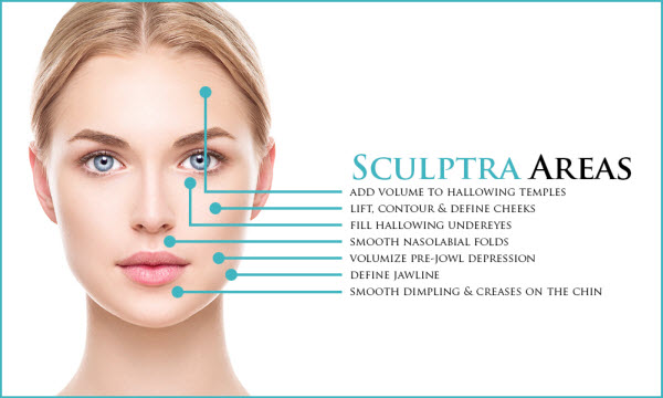 What is Sculptra Mesotherapy Treatment